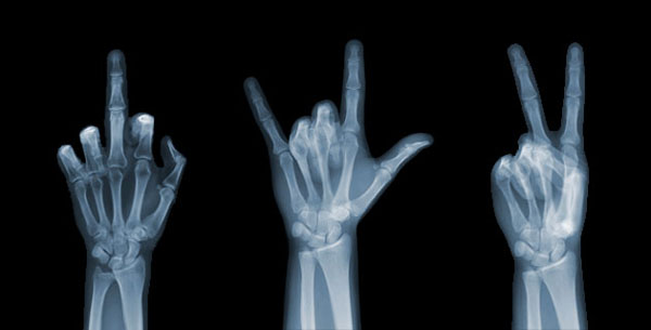 View larger image View larger image